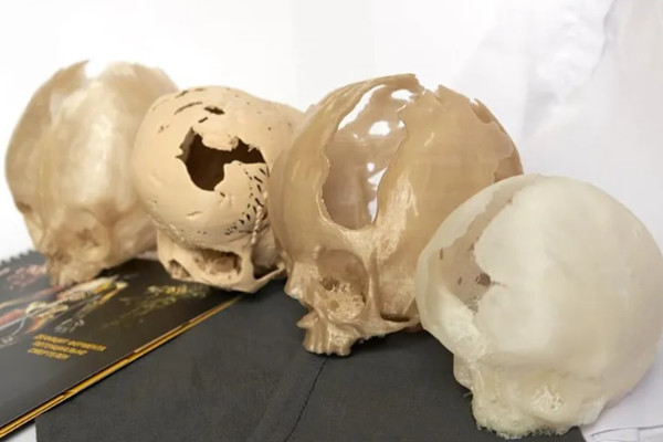 Application of 3D Printing in Medicine 8