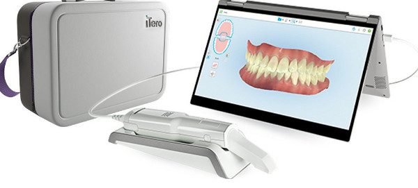 Best Intraoral Dental Scanners 12